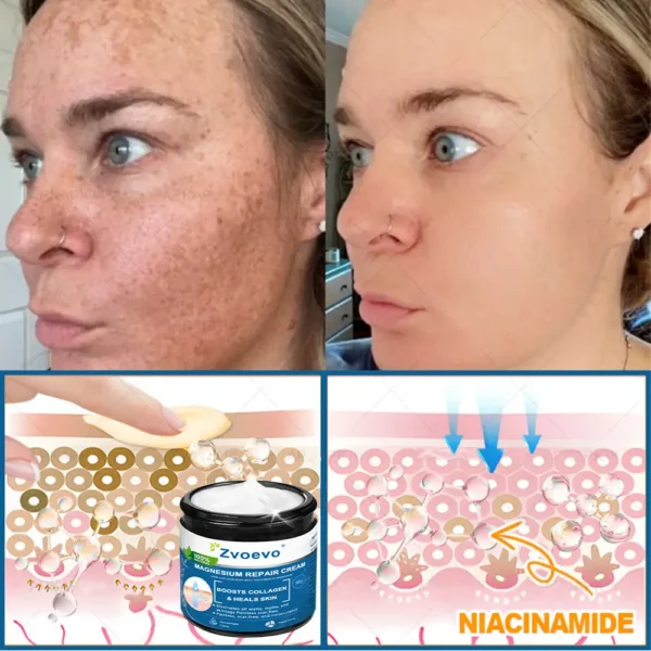 ✅Official Store: Zvoevo® Magnesium Skin Repair Cream (Smooths Wrinkles, Firms Skin and Fades Stretch Marks)