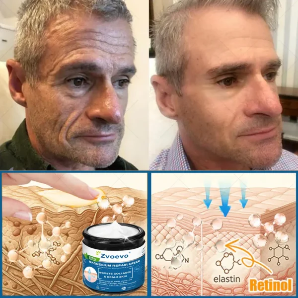 ✅Official Store: Zvoevo® Magnesium Skin Repair Cream (Smooths Wrinkles, Firms Skin and Fades Stretch Marks)