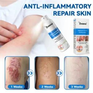 ✅Official Store: Zvoevo®Magnesium Herbal Spray⚕️FDA certified (Relief for Psoriasis and Eczema, Improvement of Bacterial Infections in the Genital Area, and Treatment of Acne and Dark Spots)