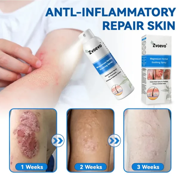 ✅Official Store: Zvoevo®Magnesium Herbal Spray⚕️FDA certified (Relief for Psoriasis and Eczema, Improvement of Bacterial Infections in the Genital Area, and Treatment of Acne and Dark Spots)