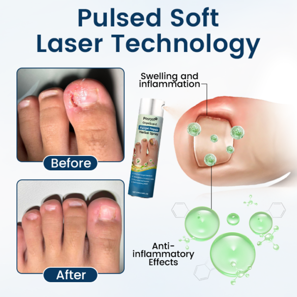 Posryst® OnyxiGuard Fungal Repair Herbal Spray