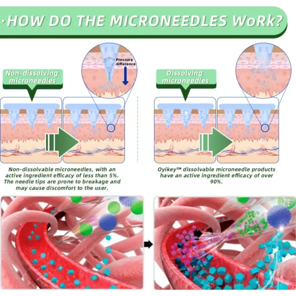 【Results in a week】 Bostore® SMGT-GLP-1 Nano Microneedle Patch