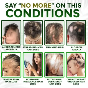 👱♂️ Blizkox® Microneedle Herbal Infusion Hair Stimulation Set 🇺🇸 Made in USA