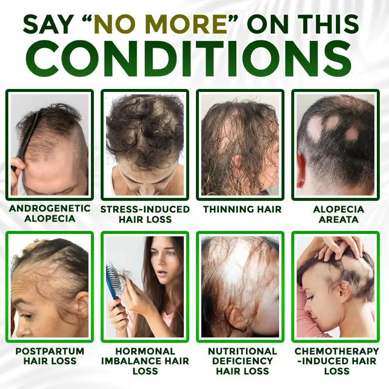 👱♂️ Blizkox® Microneedle Herbal Infusion Hair Stimulation Set 🇺🇸 Made in USA