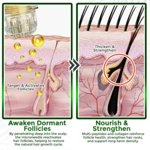 👱♂️ Blizkox® Microneedle Herbal Infusion Hair Stimulation Set 🇺🇸 Made in USA