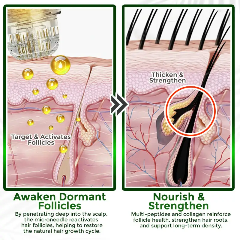 👱♂️ Blizkox® Microneedle Herbal Infusion Hair Stimulation Set 🇺🇸 Made in USA