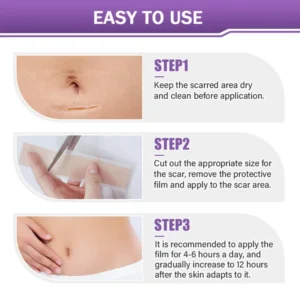 ✅Official Store |Newyuo® Skin plumping formula Nano Microneedle Repair Tape🏥(Treatment of old and new scars, reduction of surgical scars, stretch marks, keloids, acne, burns, warts, dermatomes and varicose veins)