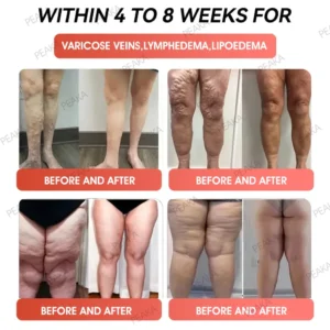 | 𝐎𝐟𝐟𝐢𝐜𝐢𝐚𝐥 USA Store | 🇺🇸 PEAKA® GLP-1 Natural Happy Estrogen Balance · Double-Layer Nanoliposome Microcapsules · Easy-to-Swallow for Middle-Aged & Older Adults (Once a day, 7-day results 💪 For obesity, diabetes, menopause relief, sleep, gut & joints)