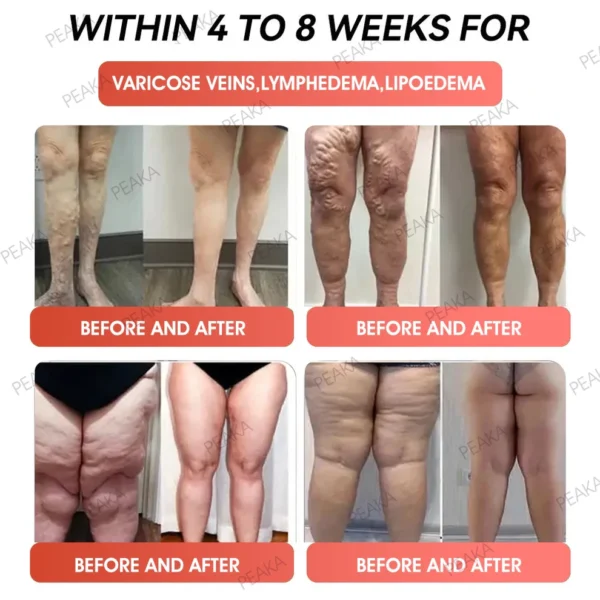 | 𝐎𝐟𝐟𝐢𝐜𝐢𝐚𝐥 USA Store | 🇺🇸 PEAKA® GLP-1 Natural Happy Estrogen Balance · Double-Layer Nanoliposome Microcapsules · Easy-to-Swallow for Middle-Aged & Older Adults (Once a day, 7-day results 💪 For obesity, diabetes, menopause relief, sleep, gut & joints)