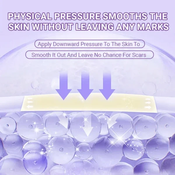 ✅Official Store |Newyuo® Skin plumping formula Nano Microneedle Repair Tape🏥(Treatment of old and new scars, reduction of surgical scars, stretch marks, keloids, acne, burns, warts, dermatomes and varicose veins)