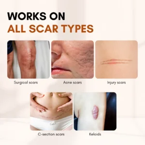 BBOJI® ClearFlaw Silicone Scar Solution Stick