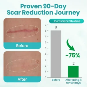 BBOJI® EliteAloe ScarSolve Spray