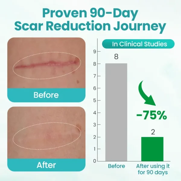BBOJI® EliteAloe ScarSolve Spray
