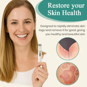 Bikenda® HPV ULTRA Genital Warts Removal Laser Pen