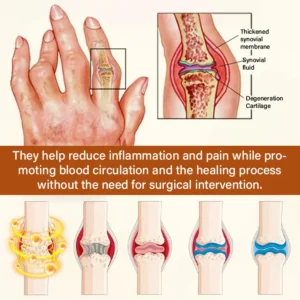 Blizkox® VenomEase Joint Cream