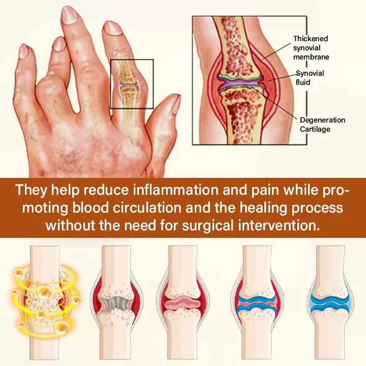 Blizkox® VenomEase Joint Cream
