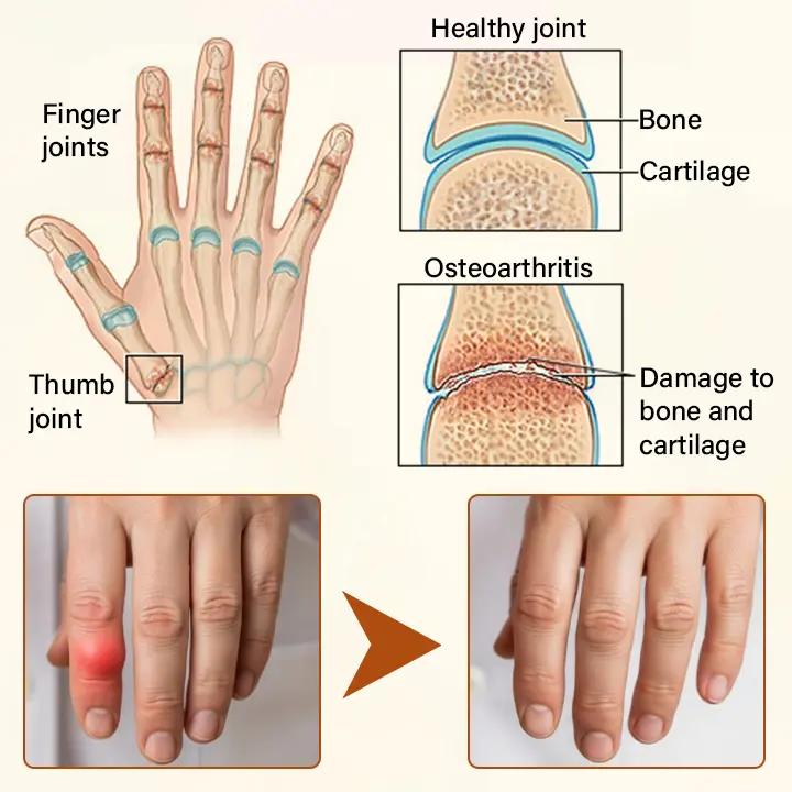 Blizkox® VenomEase Joint Cream