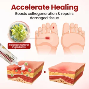 CVREOZ® DiaCare Diabetic Care Cream