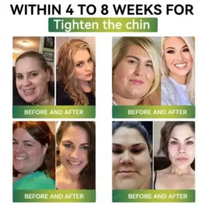 CrazyLeaf® GLP-1 Weight Loss Oral Solution Obesity,Cardiovascular Diseas, Diabetes, Sleep Apnea, Joint Problems and More