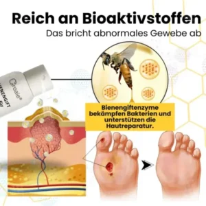 Croaie® Bienengift Spray für Diabetische Fußgeschwüre✔𝐬𝐢𝐜𝐡𝐭𝐛𝐚𝐫𝐞 𝐕𝐞𝐫𝐛𝐞𝐬𝐬𝐞𝐫𝐮𝐧𝐠 𝐢𝐧 𝟐-𝟑 𝐖𝐨𝐜𝐡𝐞𝐧✔
