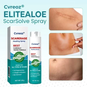 Cvreoz® EliteAloe ScarSolve Spray