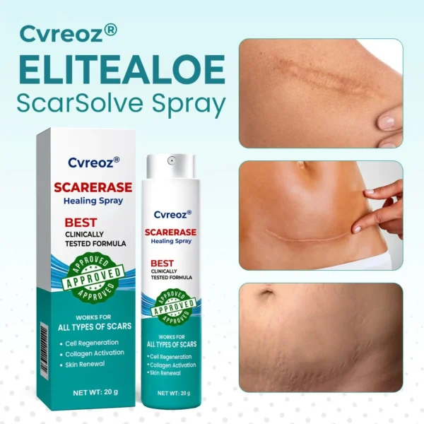 Cvreoz® EliteAloe ScarSolve Spray
