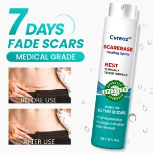 Cvreoz® EliteAloe ScarSolve Spray
