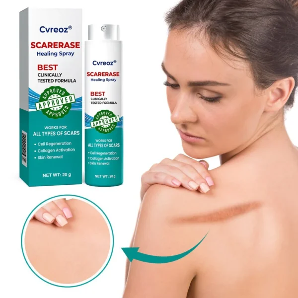 Cvreoz® EliteAloe ScarSolve Spray