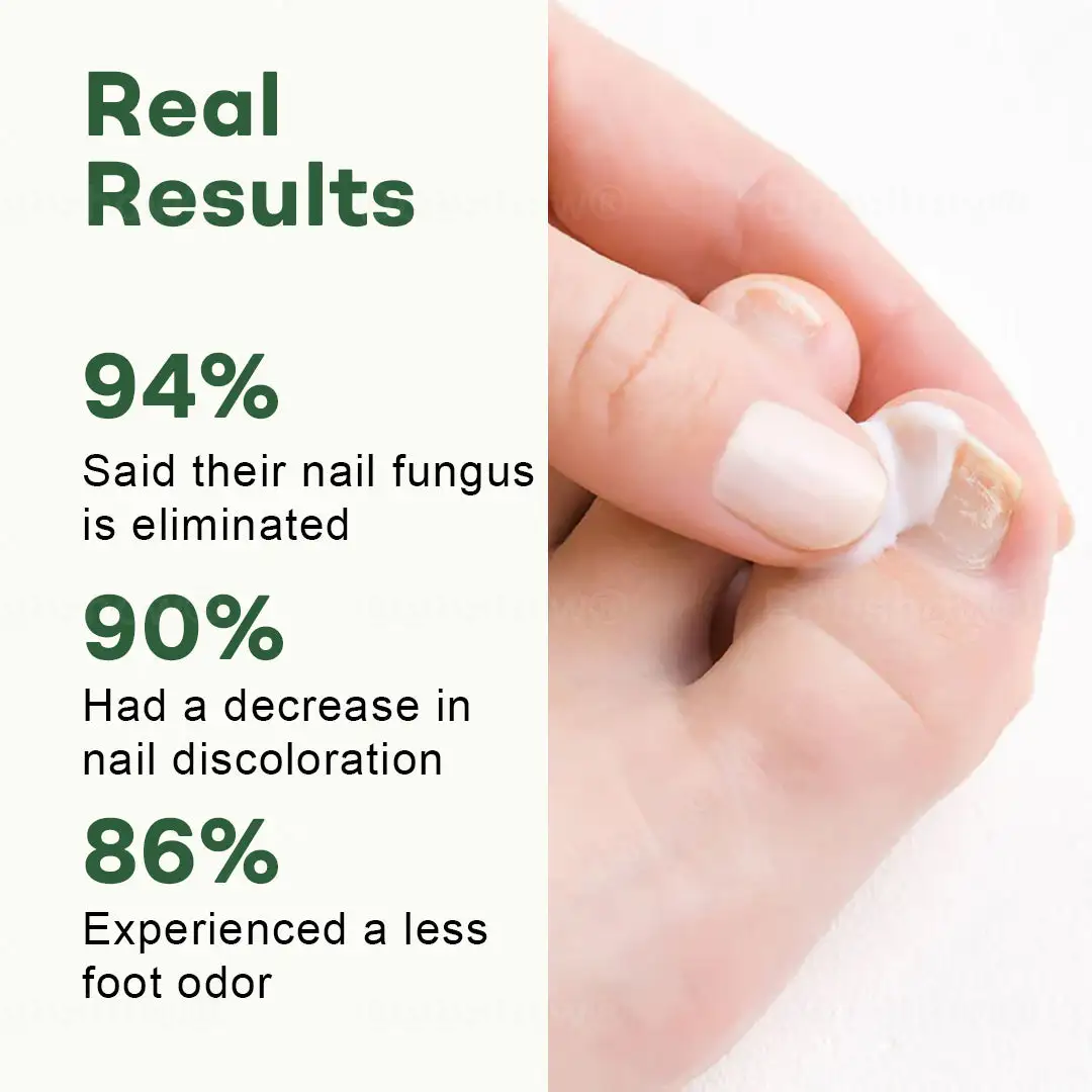 Dobshow® Nail Fungus Renewal Gel