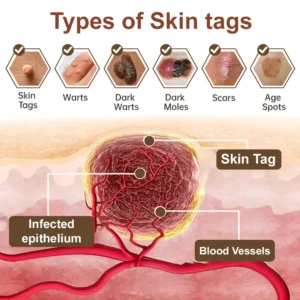 LOVILDS® Black Rice Skin Repair Essence Cream