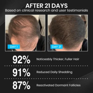 Lyyeto® HairRevix Advanced Hair Restoration Liquid Pearl