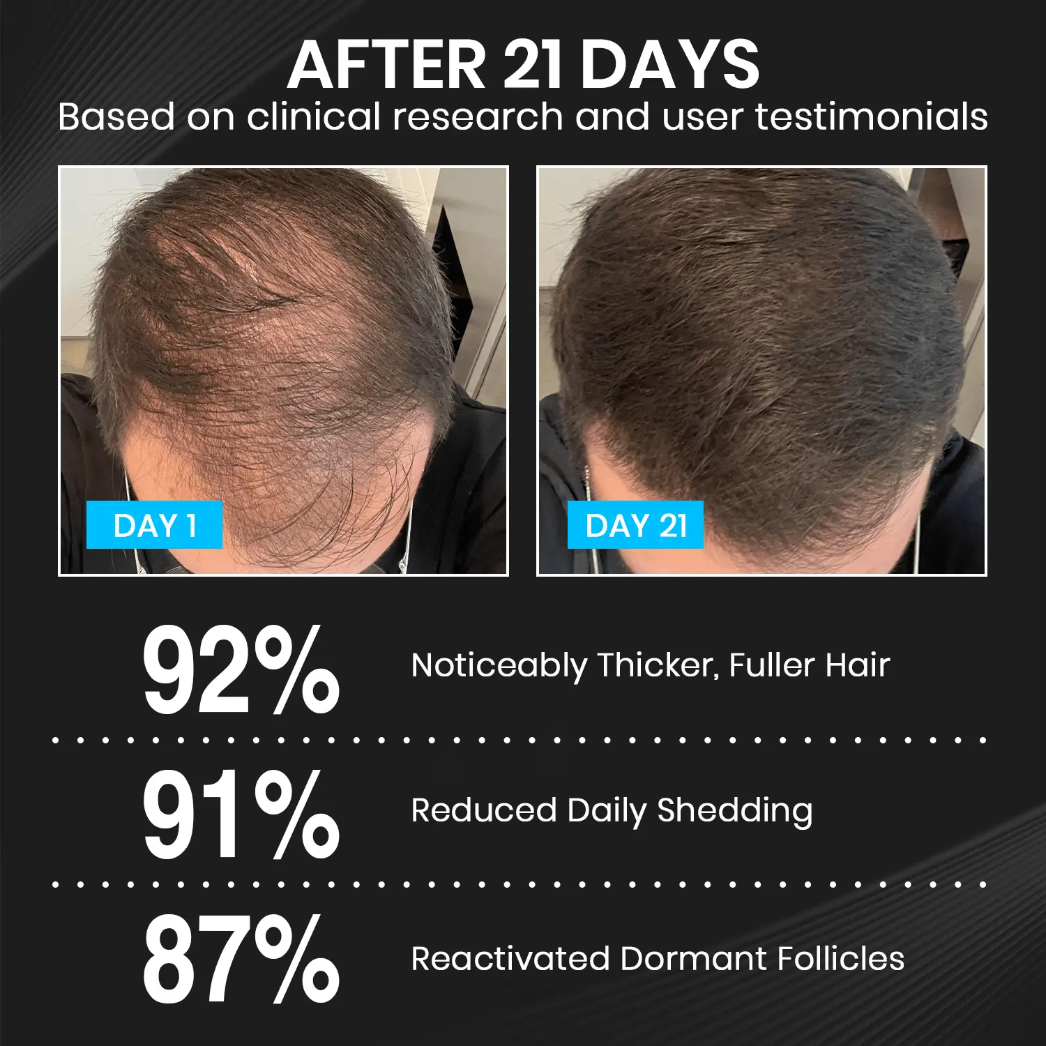 Lyyeto® HairRevix Advanced Hair Restoration Liquid Pearl