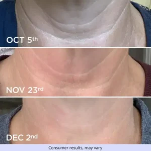 Newyuo® Tighten & Glow Moisturizer Lifts, Firms, and Restores Radiance