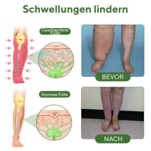 NovaRX® FluidEase Beintherapie-Ödemcreme