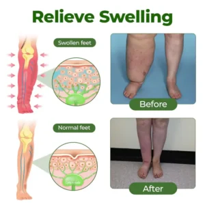 NovaRX® FluidEase Leg Therapy Edema Cream