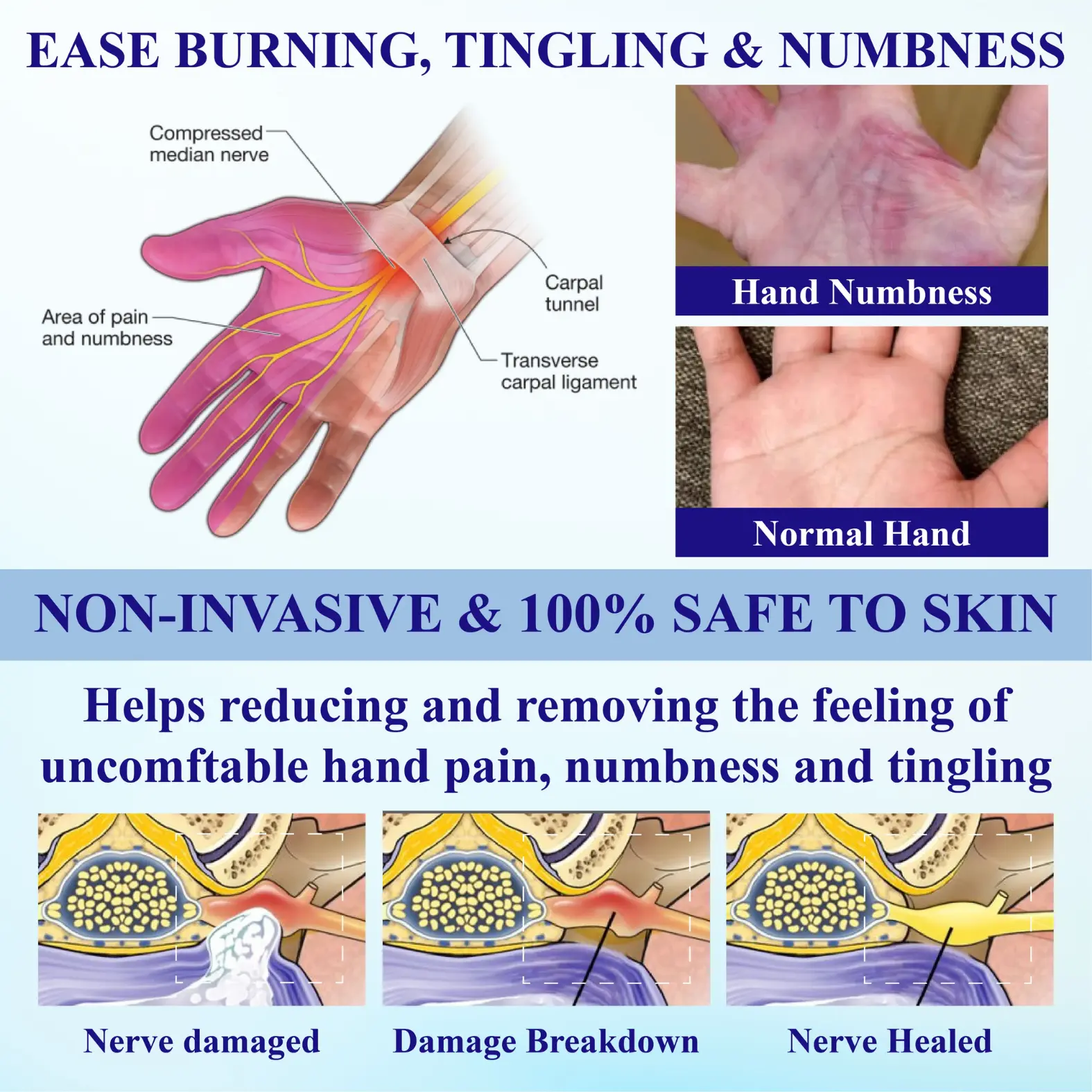 NovaRX® NumbAway CoolEase Neuropathy Spray