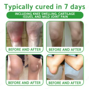 Ourlyard® Advanced Magnesium & Emu Oil Massage Pain Relief Cream