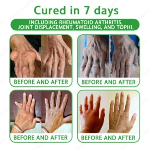 Ourlyard® Advanced Magnesium & Emu Oil Massage Pain Relief Cream