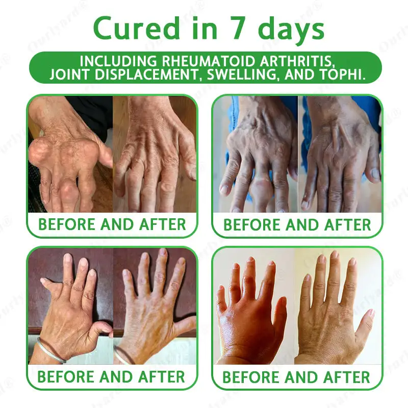 Ourlyard® Advanced Magnesium & Emu Oil Massage Pain Relief Cream