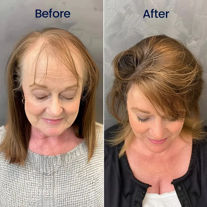 Seurico™ Maximum Strength 5% Minoxidil Fast-Action Hair Growth Serum