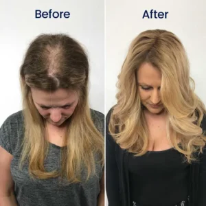 Seurico™ Maximum Strength 5% Minoxidil Fast-Action Hair Growth Serum