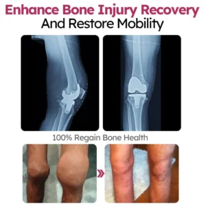 Slimoly™ Advanced Joint & Bone Renewal Cream