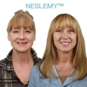 NESLEMY™ GelFit Dentures