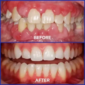 Rolimey® VioCore Bee Venom Dental Treatment Toothpaste