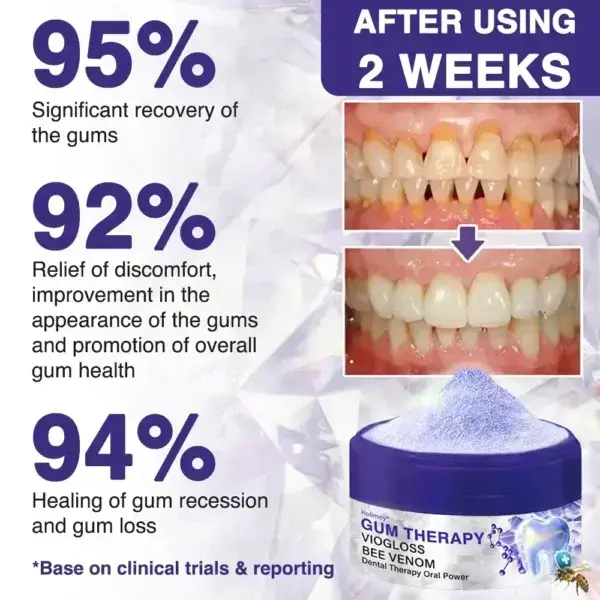 🇬🇧👨🏼⚕️Rolimey® VioGloss Bee Venom Dental Therapy Oral Power🦷