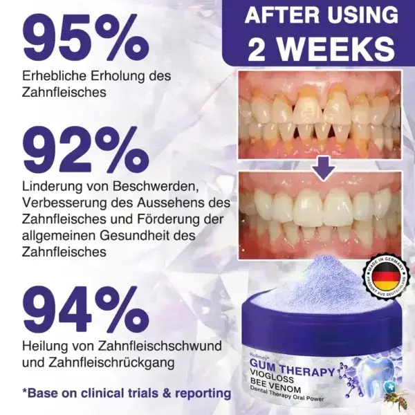 ❤️Rolimey® VioGloss Bienengift-Zahntherapie Oral Power 🦷 (🇩🇪 BZÄK Zugelassen)