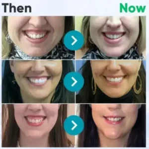 ❤️Rolimey® VioGloss Bienengift-Zahntherapie Oral Power 🦷 (🇩🇪 BZÄK Zugelassen)