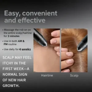 Slimoly™ Professional Anti-Hair Loss Roll-On – Stimulates Hair Growth in 1–2 Weeks