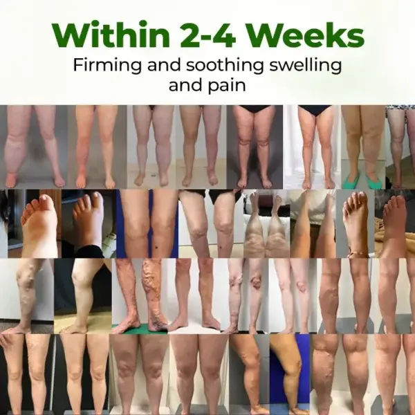 Timilk®Professional Leg Circulation Cream