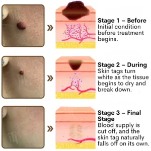 Cvreoz® Pro-Repair Black Rice Concentrate Cream